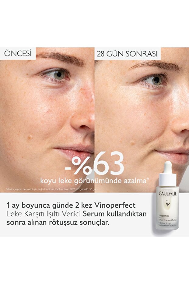 Vinoperfect Serum 30 ml - 4