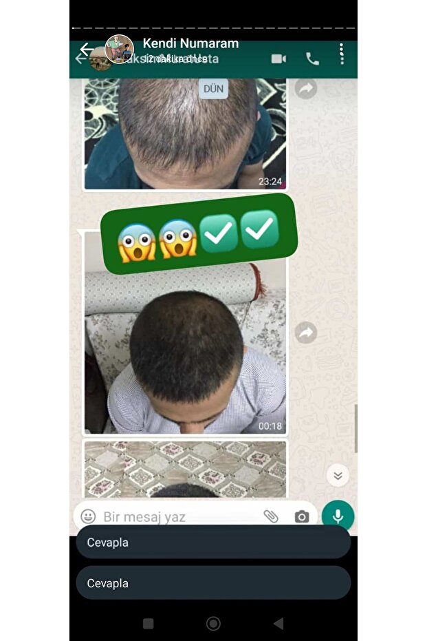 Blonde Hair Solution - 2