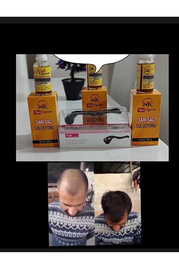 Blonde Hair Solution - 1