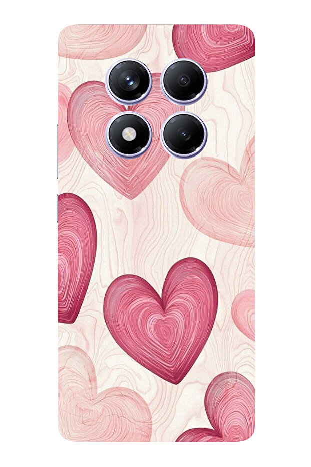 حافظة سيليكون متوافقة مع هاتف Redmi Note 14 PRO PLUS باللون الوردي الخطوي مطبوع - 1