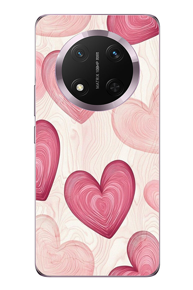 حافظة سيليكون متوافقة مع Honor Magic 7 Lite باللون الوردي الخطوي مطبوع - 1