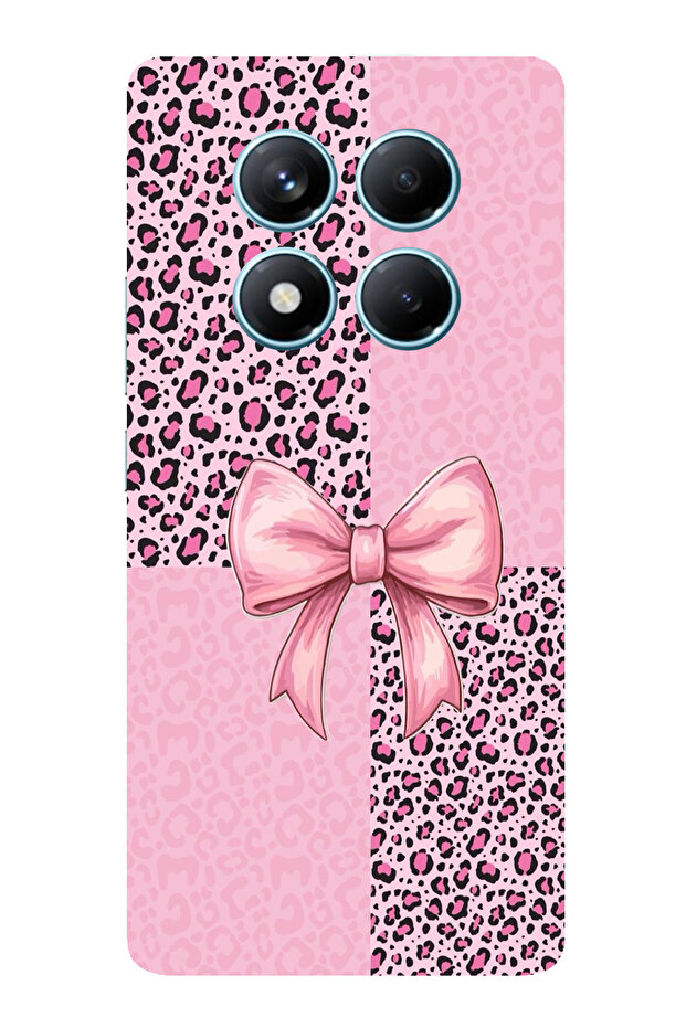Redmi Note 14 Pro 4g Compatible Pink Leopard Pattern and Ribbon Printed Silicone Case - 1