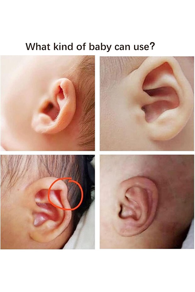 رقعة تصحيح الأذن للأطفال - 6