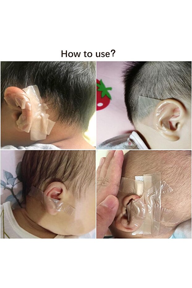 رقعة تصحيح الأذن للأطفال - 3