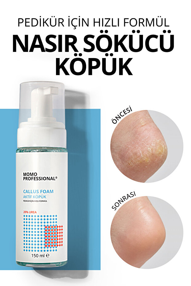 Callus Foam 150ml: Keratolytic Foam and Callus Remover for Pedicure