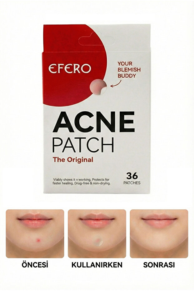 Akne Ve Bandı Pimple Patch 72 Adet Patch - 4