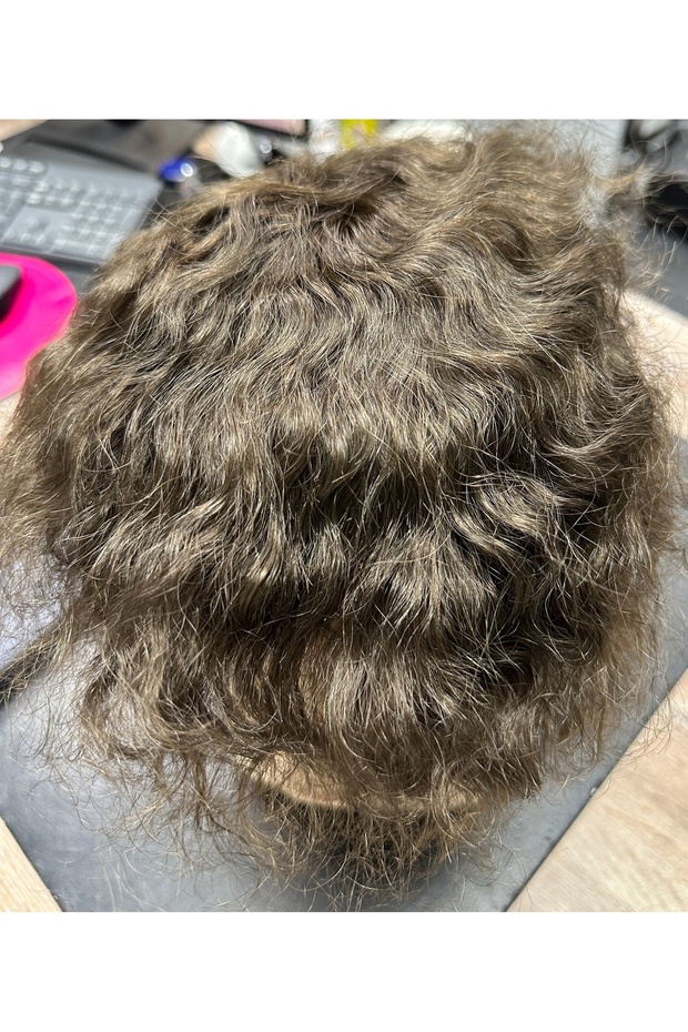 Erkek protez saç - 1
