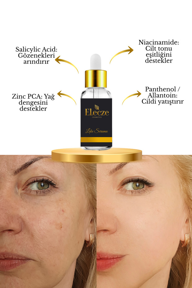 Anti-Blemish & Skin Tone Equalizing Brightening Skin Brightening Serum 30 ml