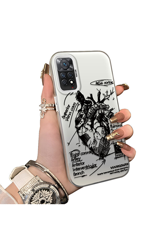 حافظة Xiaomi Redmi Note 11 Pro متوافقة مع الحافة السيليكونية الصلبة والمضادة للسقوط، بنمط إبداعي - 1