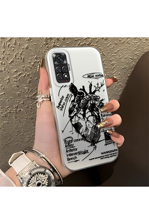 حافظة Xiaomi Redmi Note 11S متوافقة مع الحافة السيليكونية الصلبة والمضادة للسقوط، بنمط إبداعي - 5