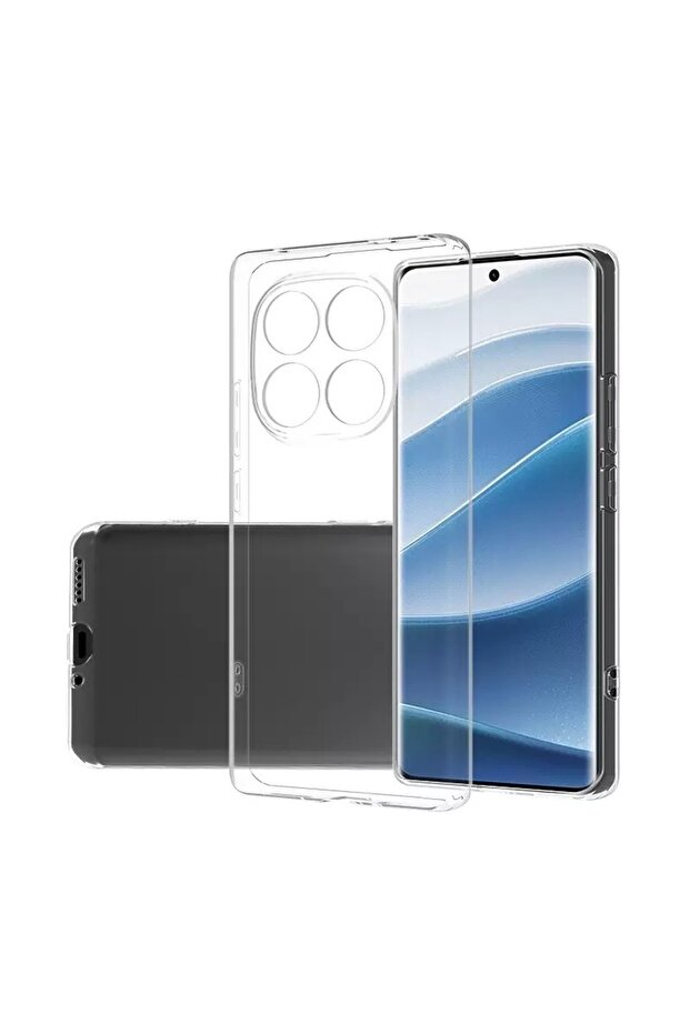 حافظة ريدمي نوت 15 برو بلس من السيليكون الشفاف - 1
