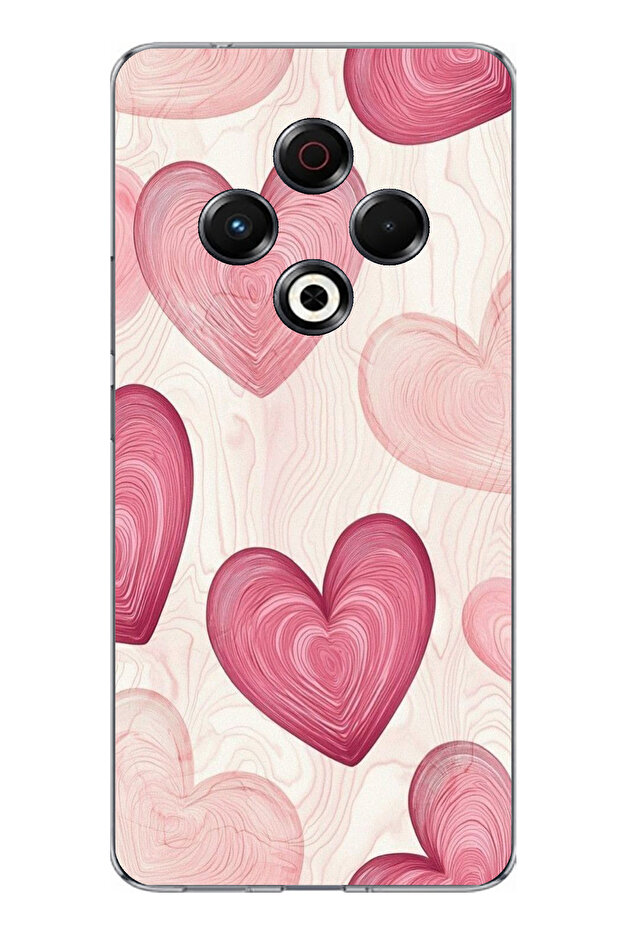 حافظة سيليكون متوافقة مع هاتف Tecno Spark 30 باللون الوردي الخطوي مطبوع - 1