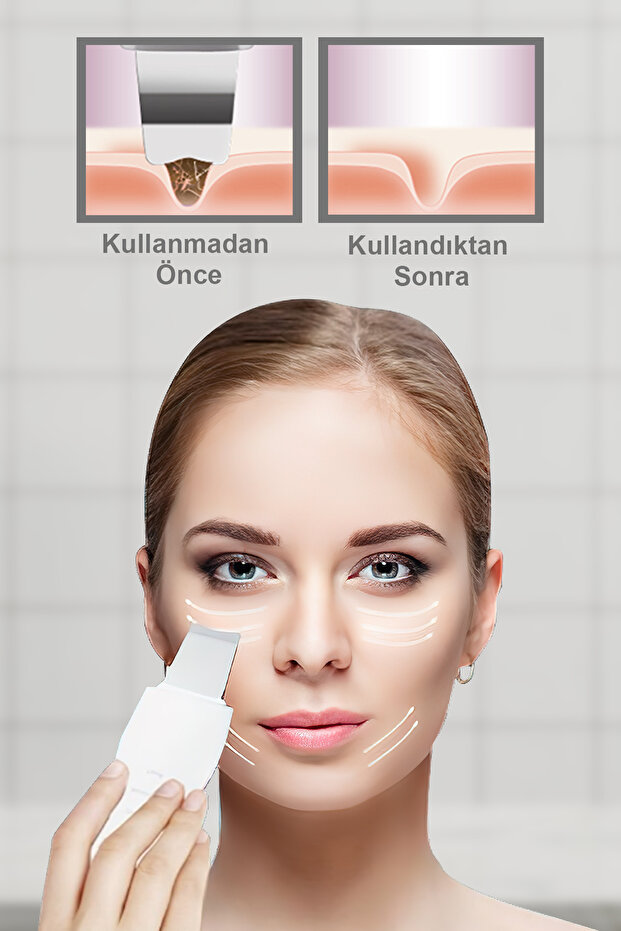 Kalın Gövde Ultrasonic Spatula - 7