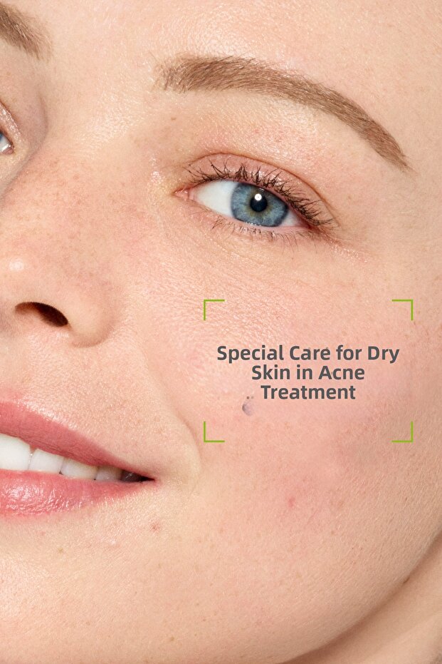 Sebium Hydra 40 мл - 3