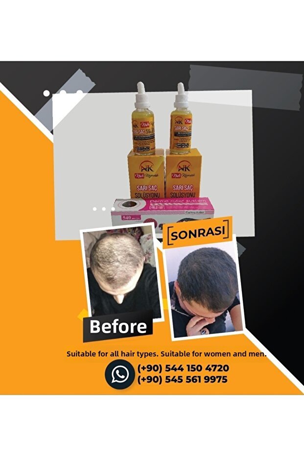 محلول الشعر الأشقر - 3