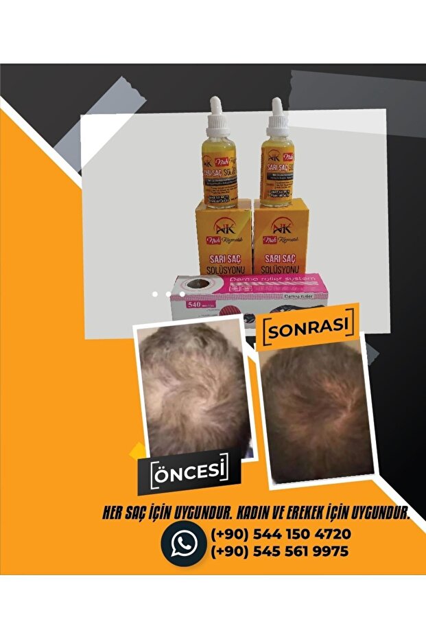 Sarı saç solusyonu - 1