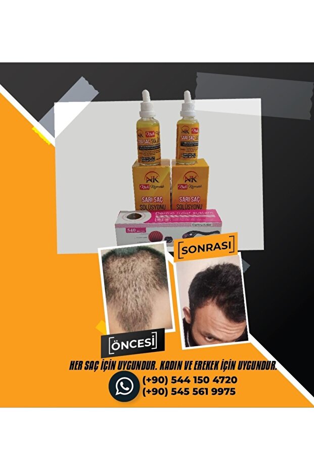 Sarı saç solusyonu - 7