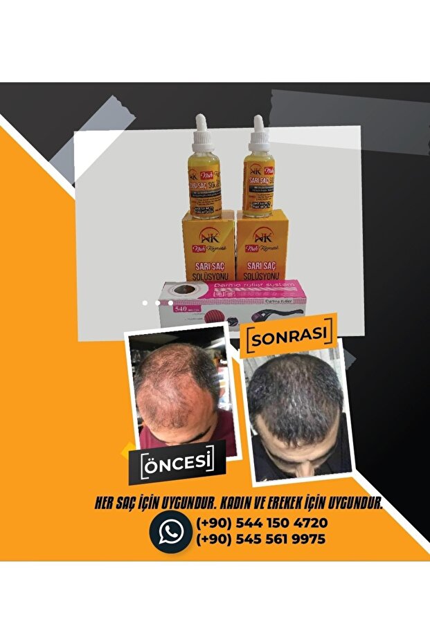 Sarı saç solusyonu - 6
