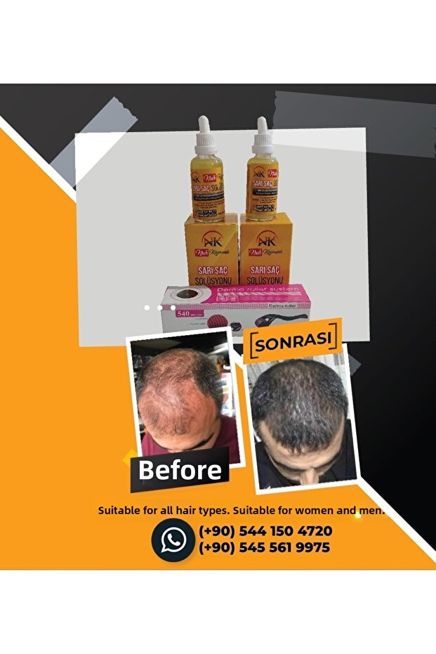 محلول الشعر الأشقر - 5