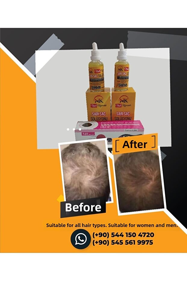 محلول الشعر الأشقر - 1