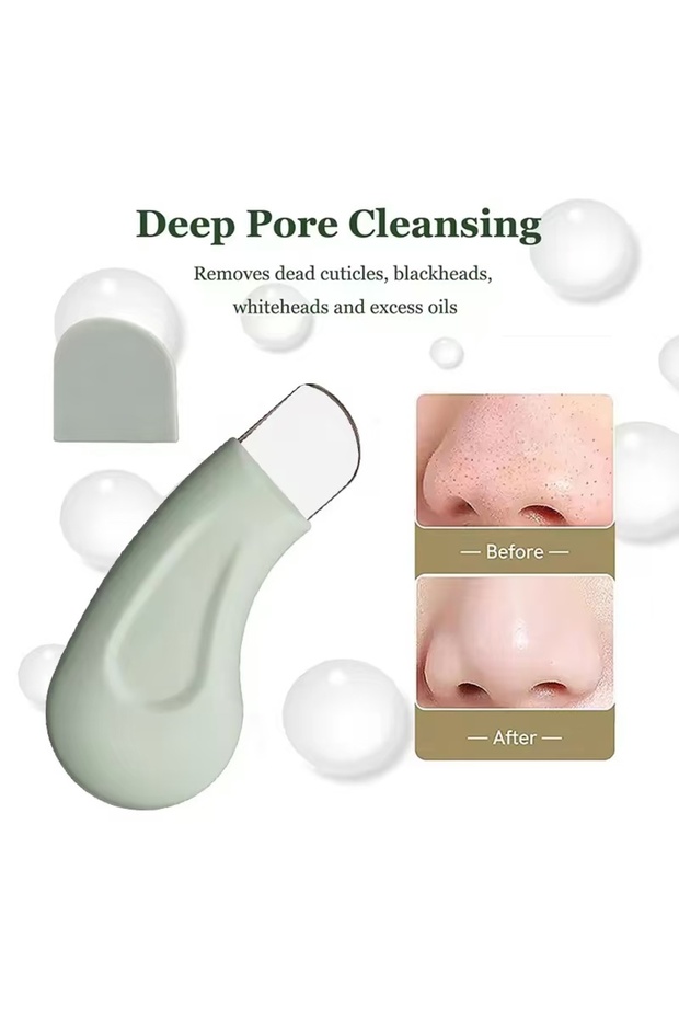 green Blackhead and Whitehead Removal Tool for Nose and Face - Skin Pore Cleaner Skin Care Tools for