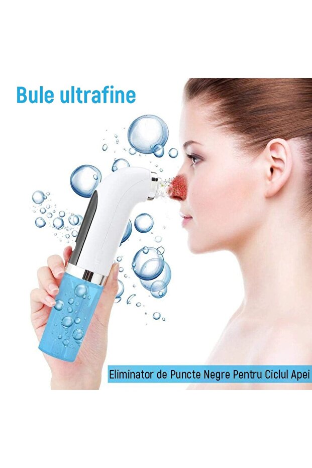 Blackhead Remover Device - 4