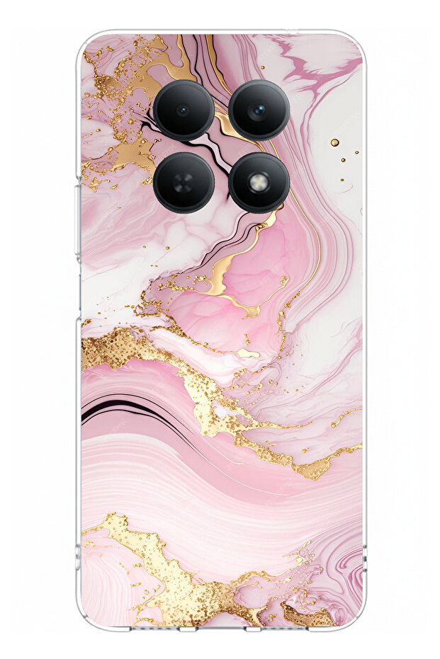 حافظة سيليكون مطبوعة باللون الوردي الرخامي متوافقة مع هاتف Redmi Note 15 4G - 1