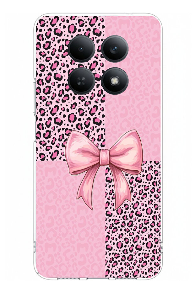 حافظة سيليكون متوافقة مع هاتف Redmi Note 15 4G بنمط الفهد الوردي وطباعة الشريط - 1