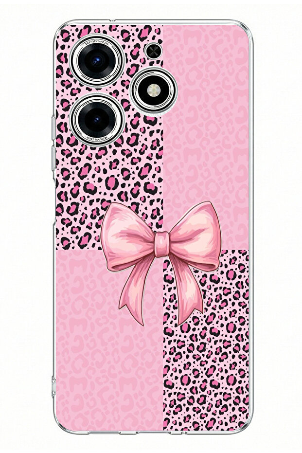 حافظة سيليكون متوافقة مع هاتف تكنو سبارك 10 برو بنمط الفهد الوردي وطباعة الشريط - 1