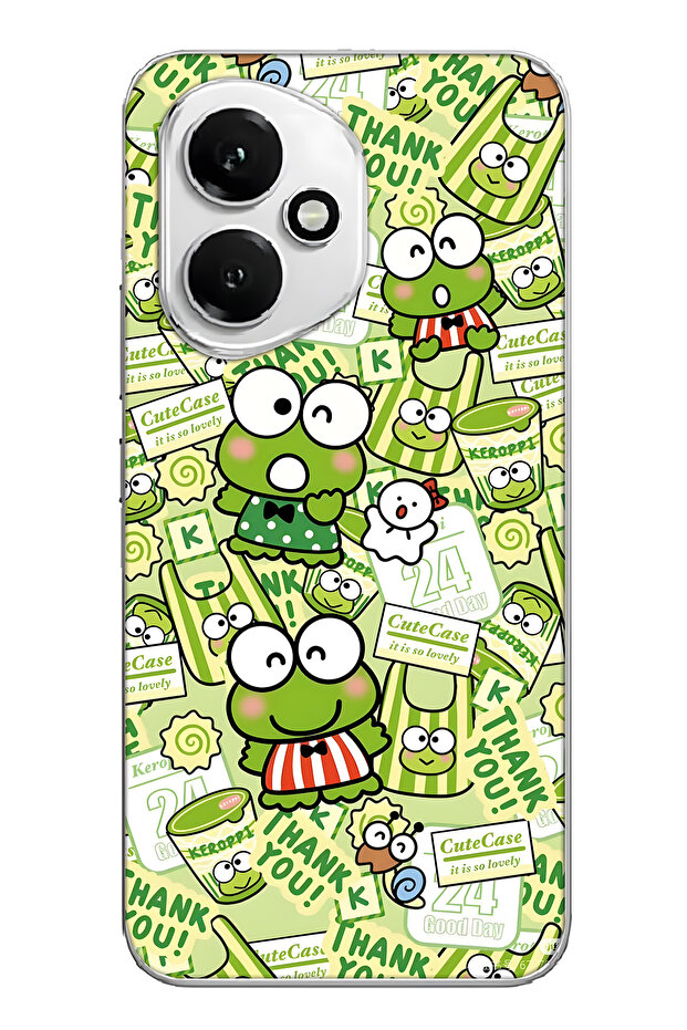 غطاء هاتف شفاف بنمط الضفدع اللطيف متوافق مع هونور 400 - 1