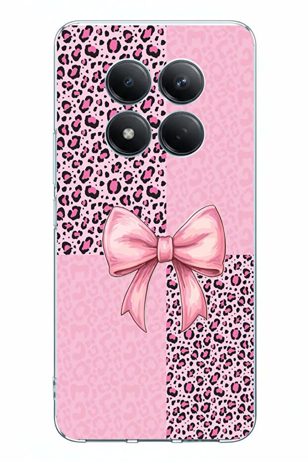 حافظة سيليكون متوافقة مع هاتف Redmi Note 15 PRO 5G بنمط الفهد الوردي وطباعة الشريط - 1