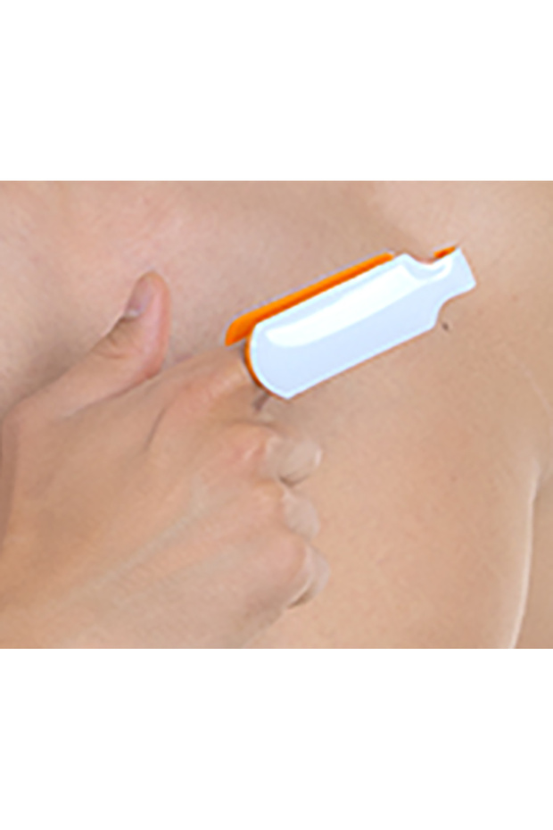 Code: 32 - Stabilization Splint - 7