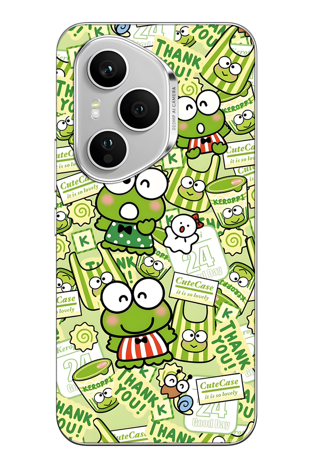 غطاء هاتف شفاف بنمط الضفدع اللطيف متوافق مع هونر 400 برو - 1