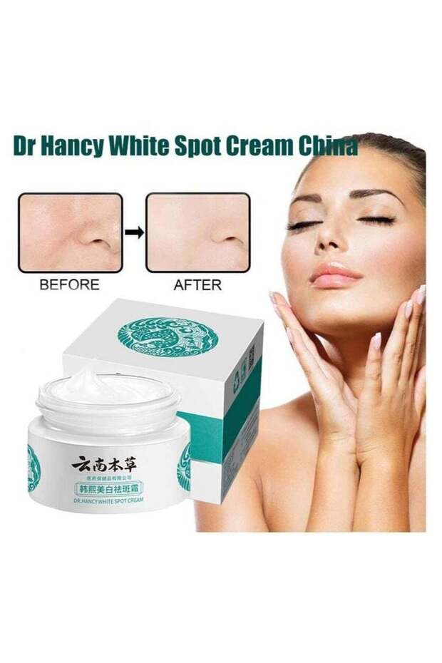 Japanese Melasma Cream