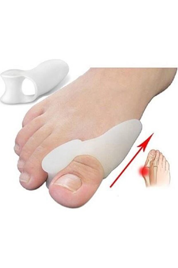 Silikon Makara Ayak Baş Parmak Bunyon Nasır Kemik Koruyucu Ayıran - 3