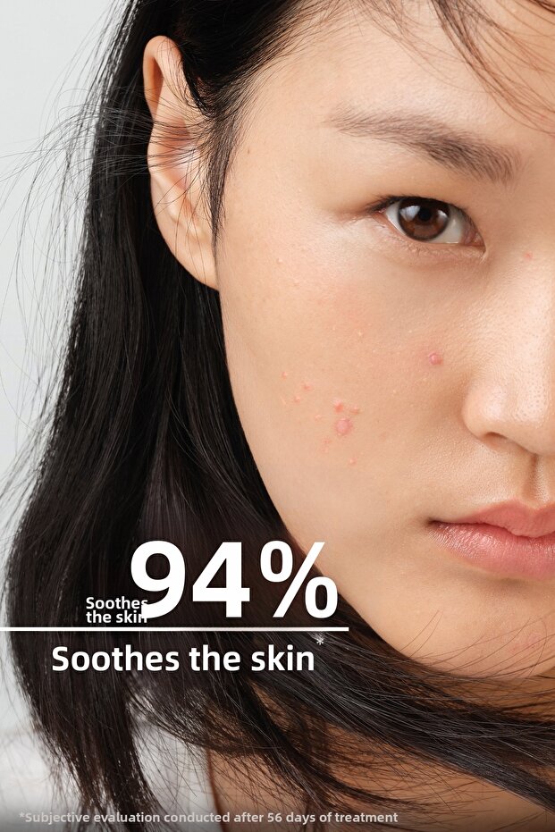 Sebium Sensitive 30 мл - 5