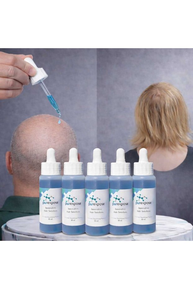 Hair Care Hair Growth Promoting Lengthening Strengthening Repairing Hair Lotion 5 Pieces