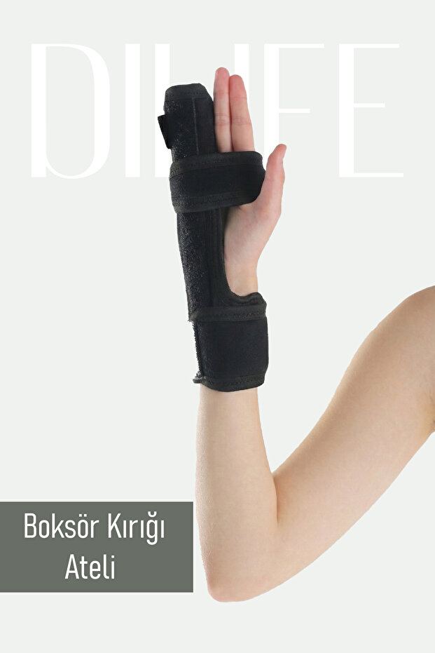 Sparrow Ring Finger Fracture Splint Metacarpal Fracture Fractured Boxer Fracture Right&Left Compatible