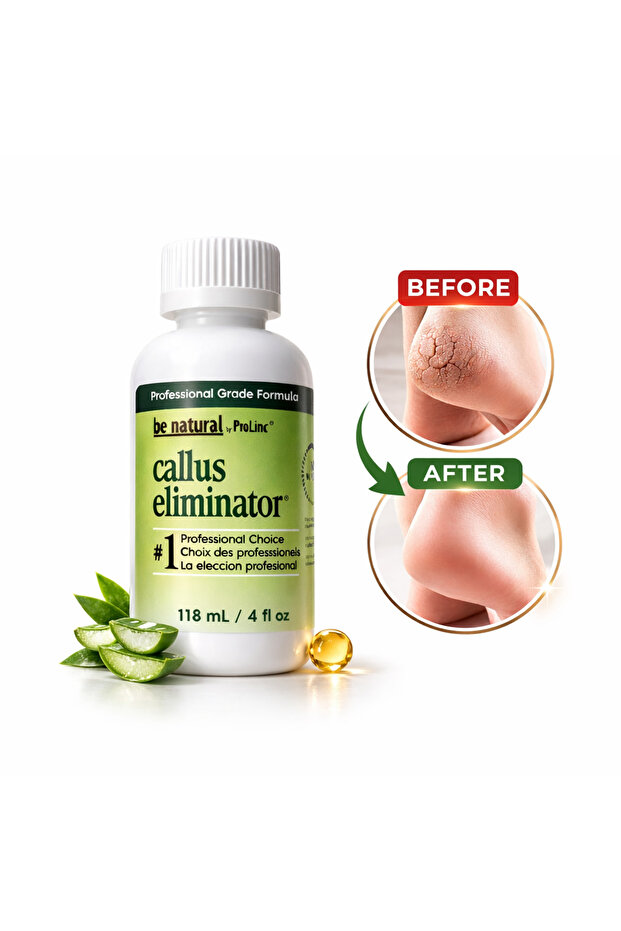 Callus Foot Care Solution - 2