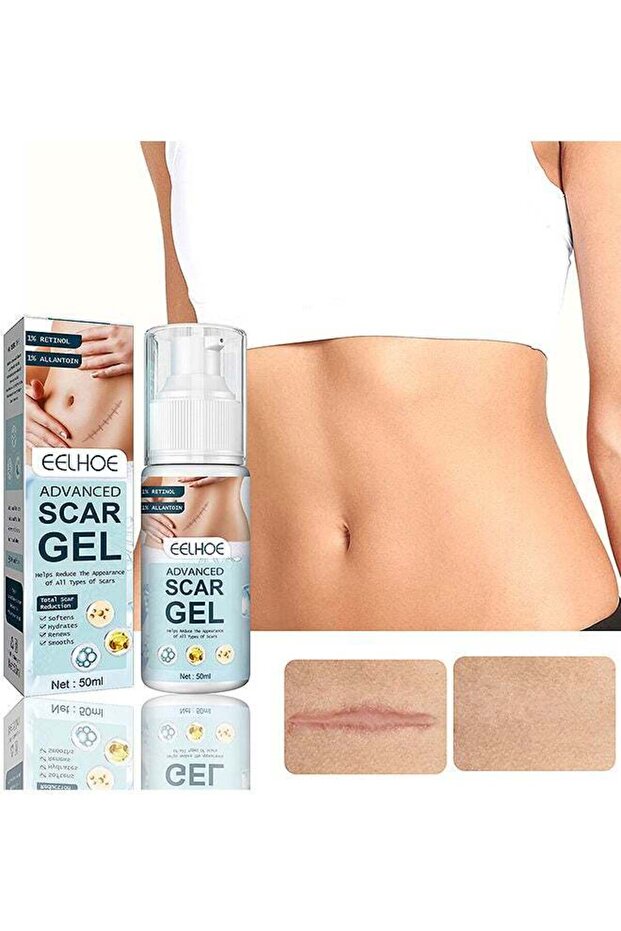 Advanced Scar Gel, Medical Grade Scar Gel