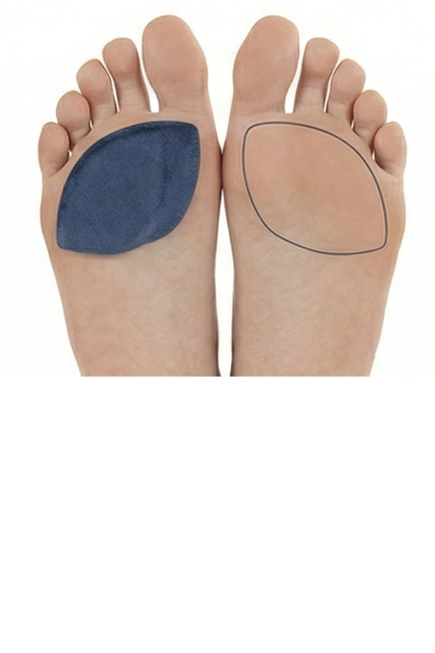 الكود: 315 دعامة سيليكون للقوس (لاصقة) - 5