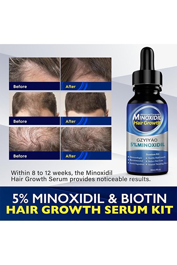 خلاصة محلول النمو بنسبة 5% - 7