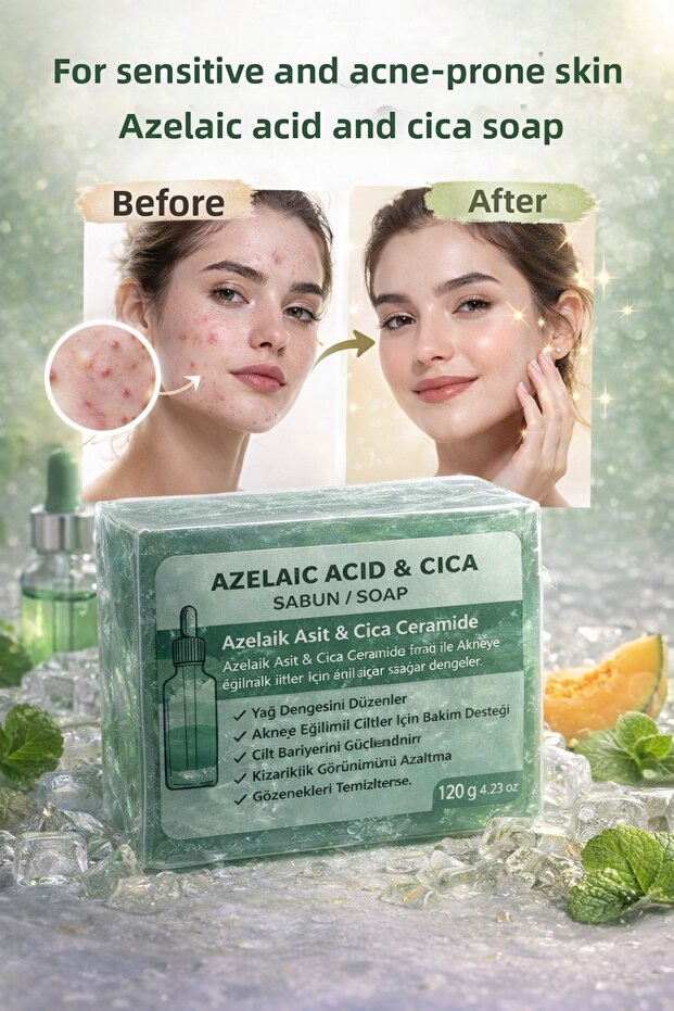 Azelaic Acid Cica Soap – Anti-Acne Skin Care Soap