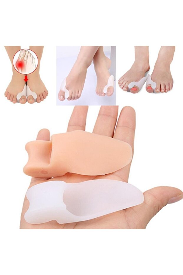 Silikon Makara Ayak Baş Parmak Bunyon Nasır Kemik Koruyucu Ayıran - 5