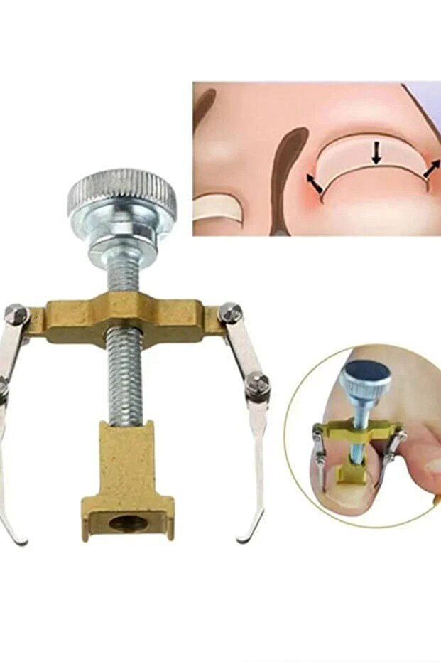 Ingrown Nail Correction Apparatus Stainless Steel Ingrown Nail Remover Organizer