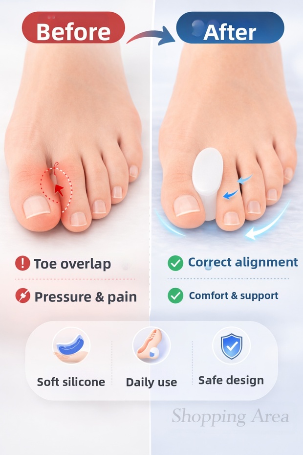 Silicone Toe Separator Roller Large (42-46) – Hallux Valgus Thumb Corrector Pad (2 Pieces)