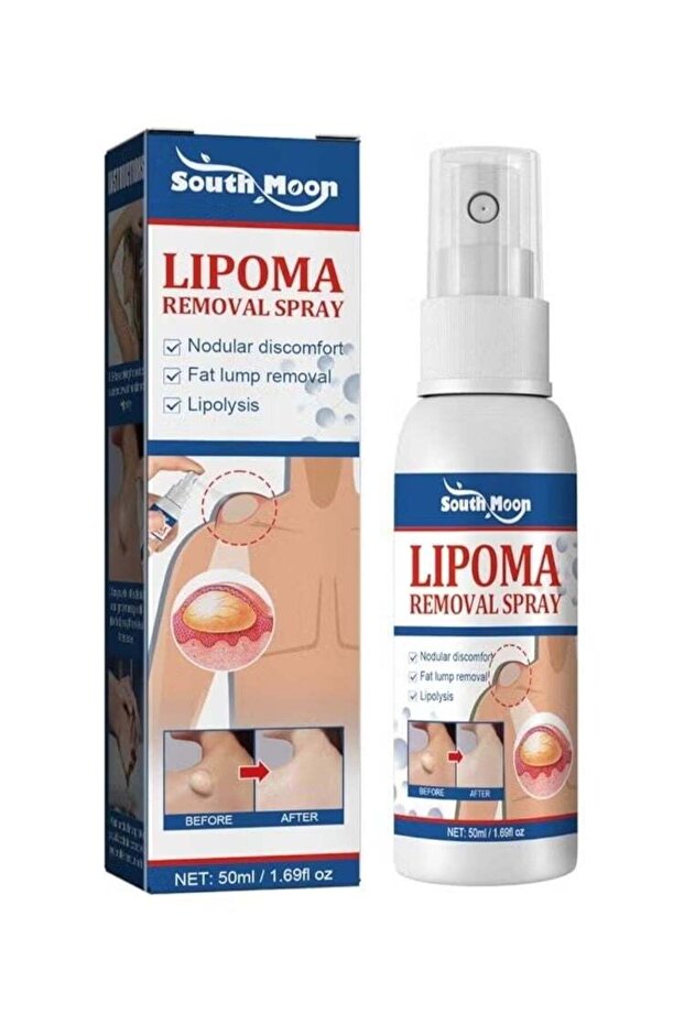 Southmoon Lumpfree Lipoma Removal Spray 2 pcs