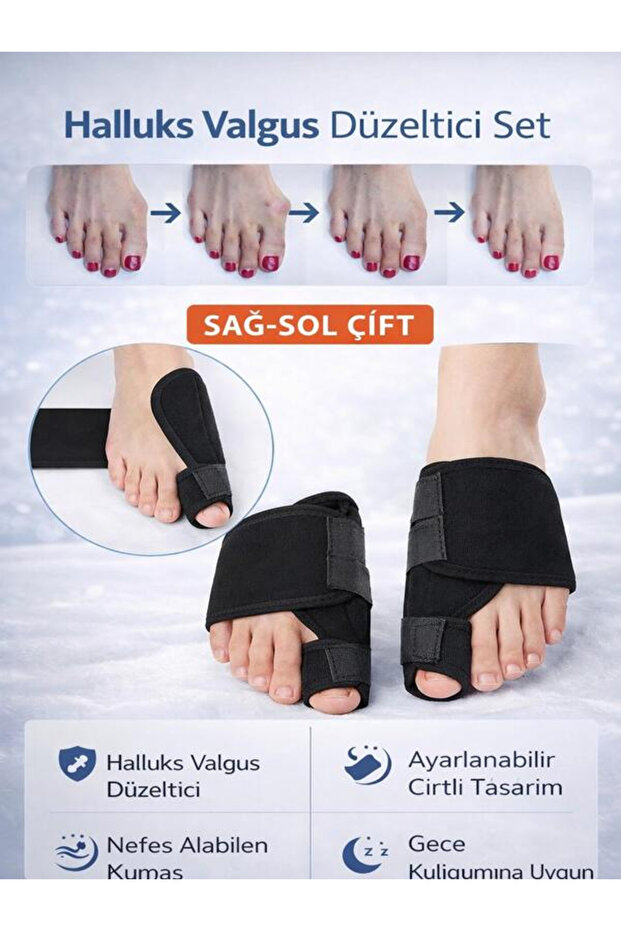 Medical Orthopedic Hallux Valgus Night Big Toe Splint Foot Big Toe Bone Corrector Foot Splint