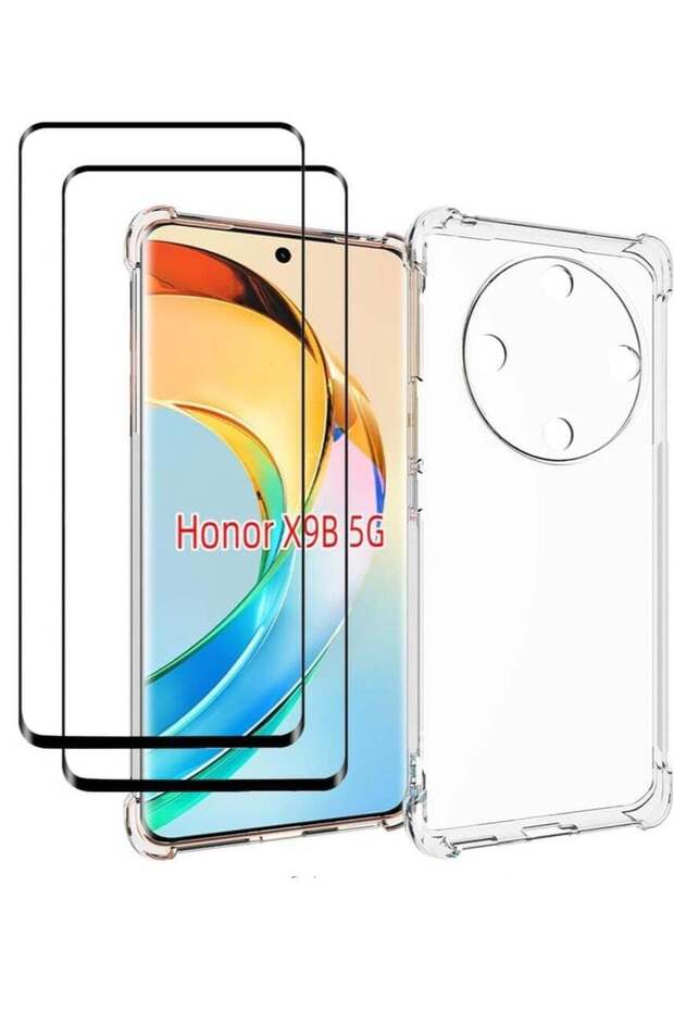 "Honor X9b 5G Clear Protective Case & Screen Protector Set - Slim, Scratch-Resistant Cover with Temp
