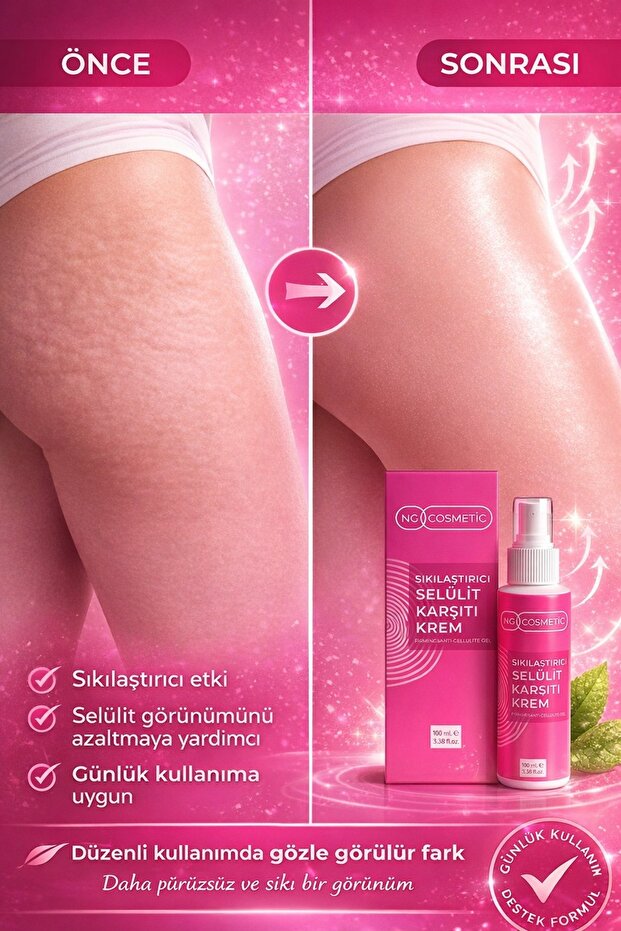 NG Kozmetik Selülit ve Çatlak Karşıtı Bakım Kremi - Coenzyme Q10 & Kafein Etkili Sıkılaştırıcı 100 ML